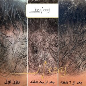 پک پاکسازی بدن بهبود ریزش مو و رشد مجدد مو