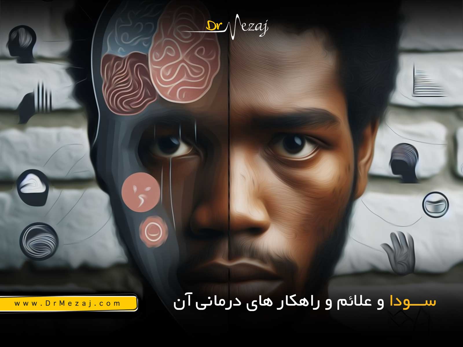 سودا چیست